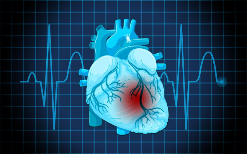Interventional Cardiology